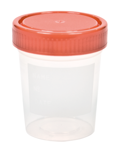 FRASCO PARA MUESTRAS - 100 cc (TAPA ROJA)